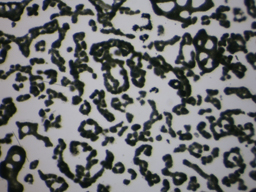 phytoplankton
